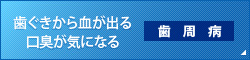 歯ぐきから血が出る口臭が気になる 歯周病