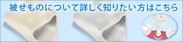 被せものについて詳しく知りたい方はこちら